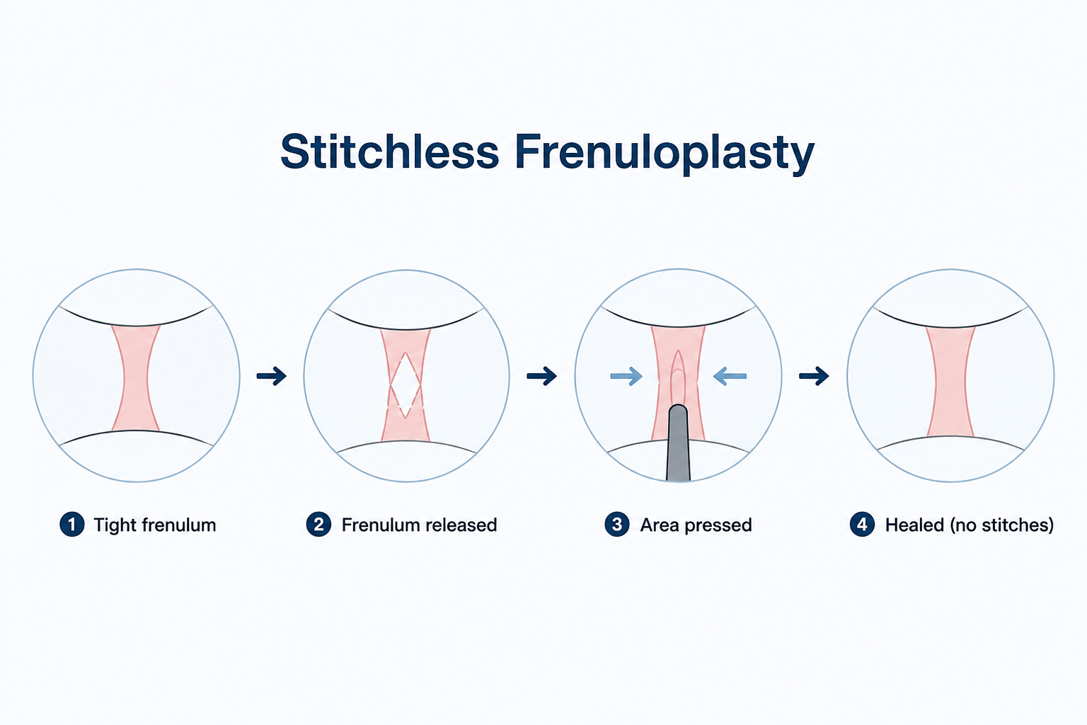 Can Penis Skin Be Repaired Without Stitches?