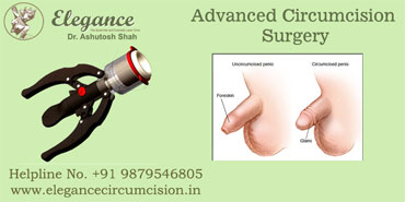 advanced circumcision