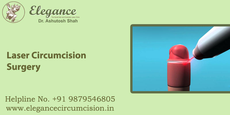 Laser Circumcision in surat