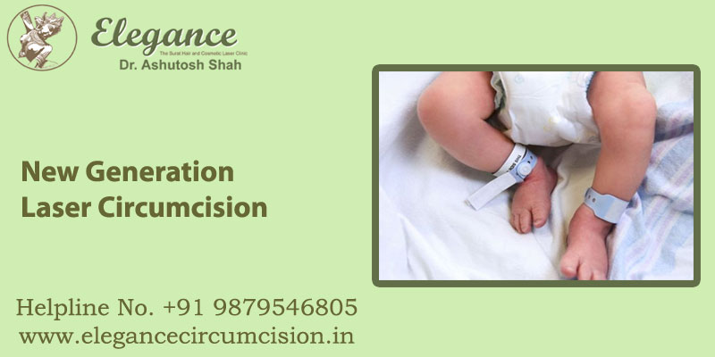 New Generation Laser Circumcision in surat