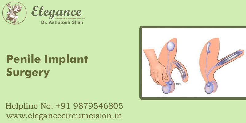 Penile Implant Surgery