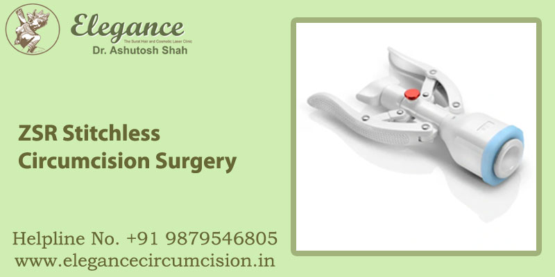 ZSR Stitchless Circumcision Surgery in surat