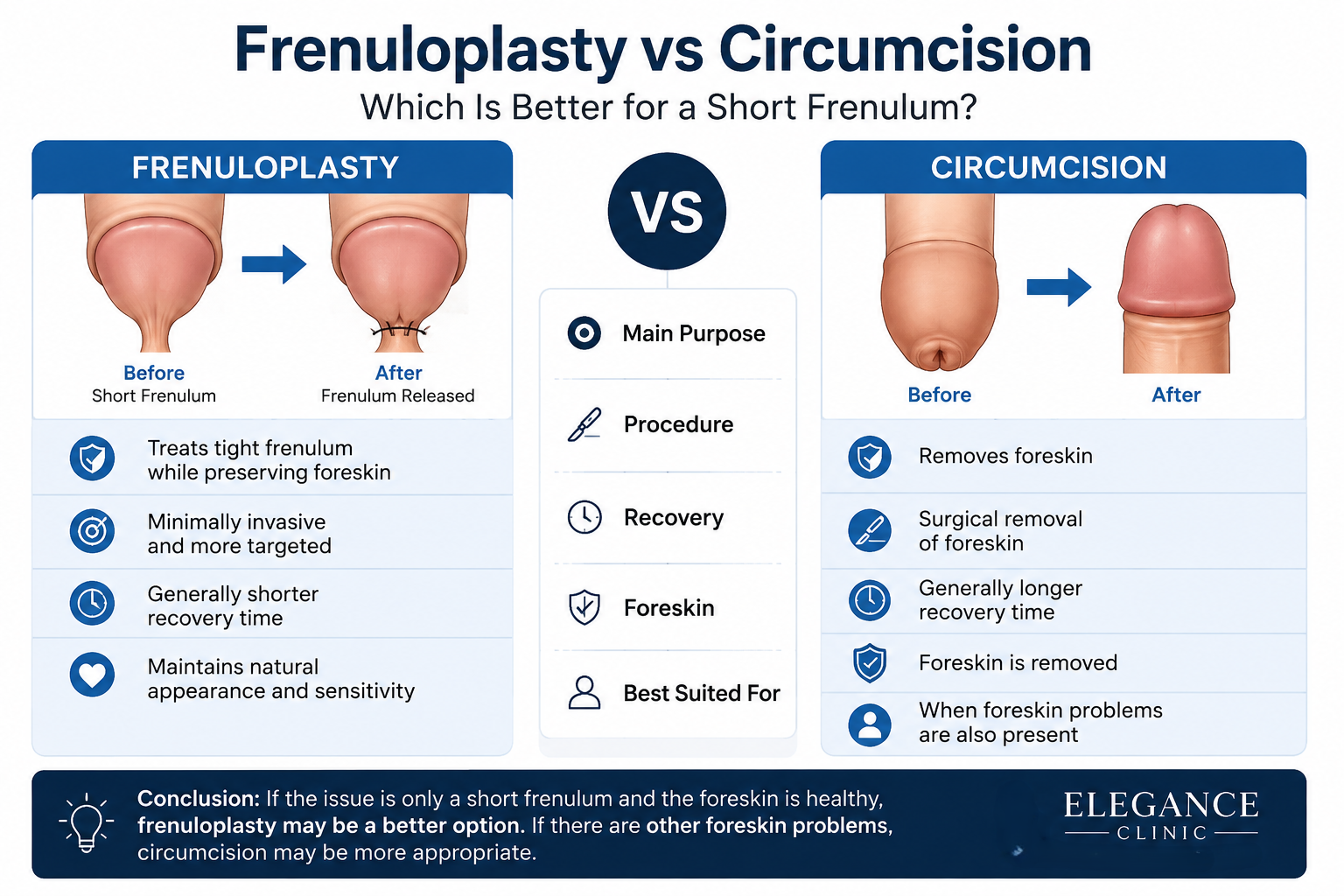Is Frenuloplasty Better Than Circumcision for a Short Frenulum?